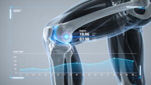 A high-tech motion analysis software display tracking human joint stress points during an athletic cutting maneuver.